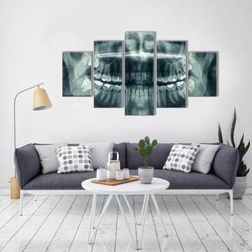 Xray See Through Dentist - Abstract 5 Panel Canvas Art Wall Decor Xray See Through Dentist - Abstract 5 Panel Canvas Art Wall Decor